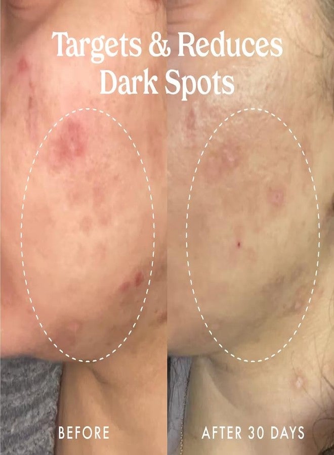 Kopari Star Bright Vitamin C Discoloration Correcting Serum with Kakadu Plum & Niacinamide, Brighter Complexion, Soothe & Diminish Dull Skin, 1.7oz - Image 5